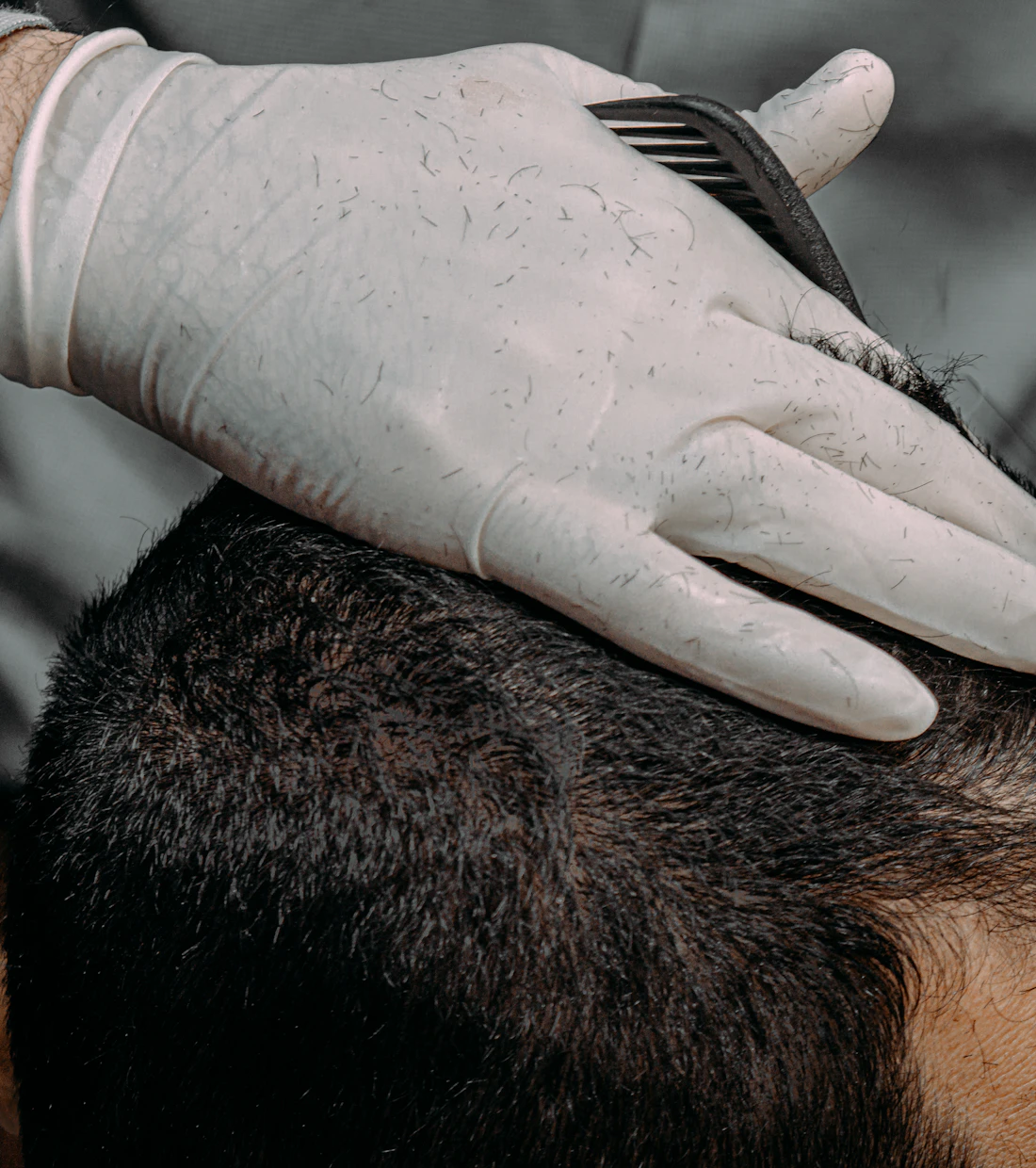 Gloved hand working on a client's scalp
