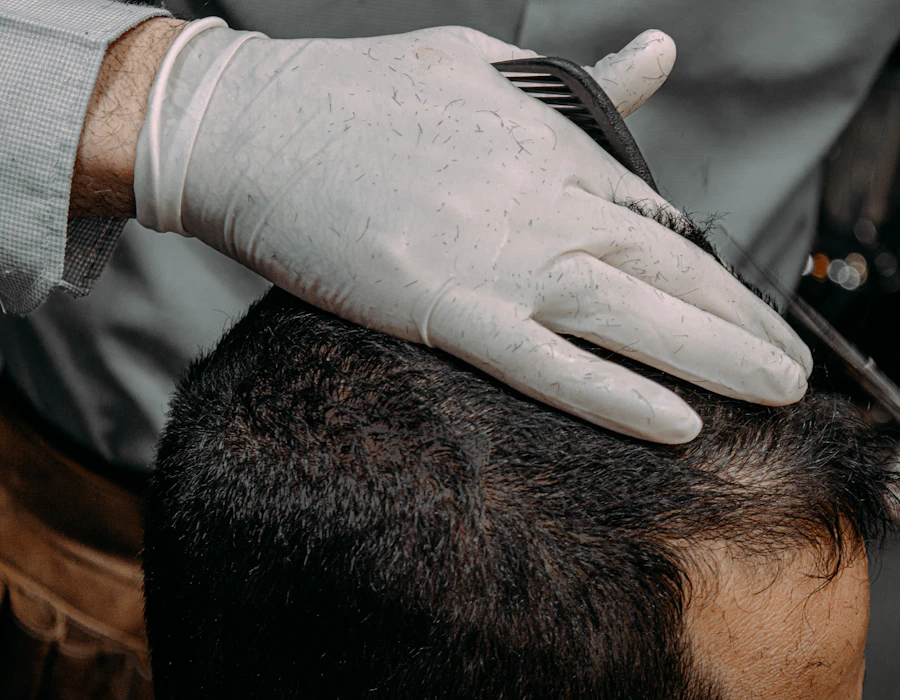 Gloved hand working on a client's scalp